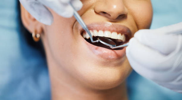 Best Emergency Dental Extractions in Kingsburg, CA