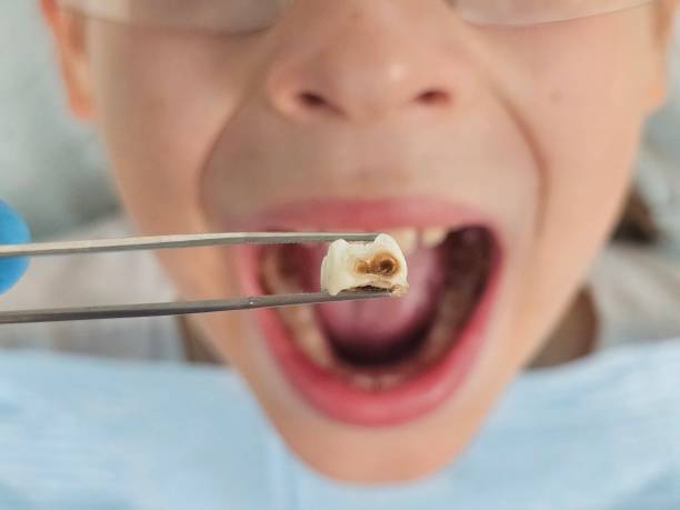 Best Emergency Dental Services for Seniors in Kingsburg, CA